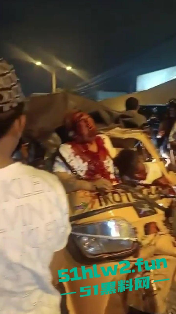 老头乐车祸现场因超速追尾，老头被当场甩出满脸是血，这回老头乐坏了老头也不乐了。-3